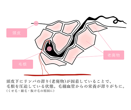 ボコボコ 頭皮