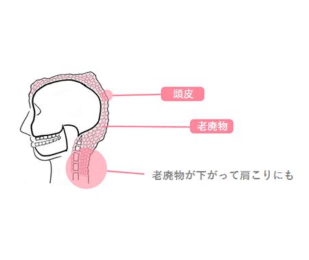 ボコボコ 頭皮